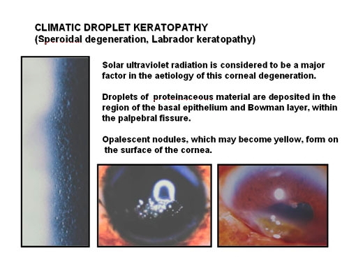 specular reflection cornea