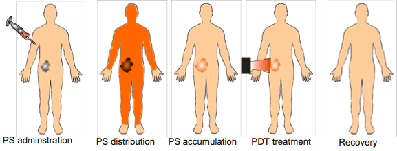 Figure 14