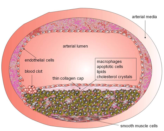 Figure 18