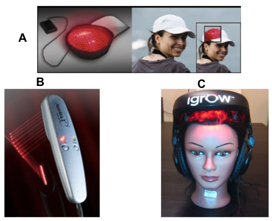 low level laser light therapy for hair loss #10